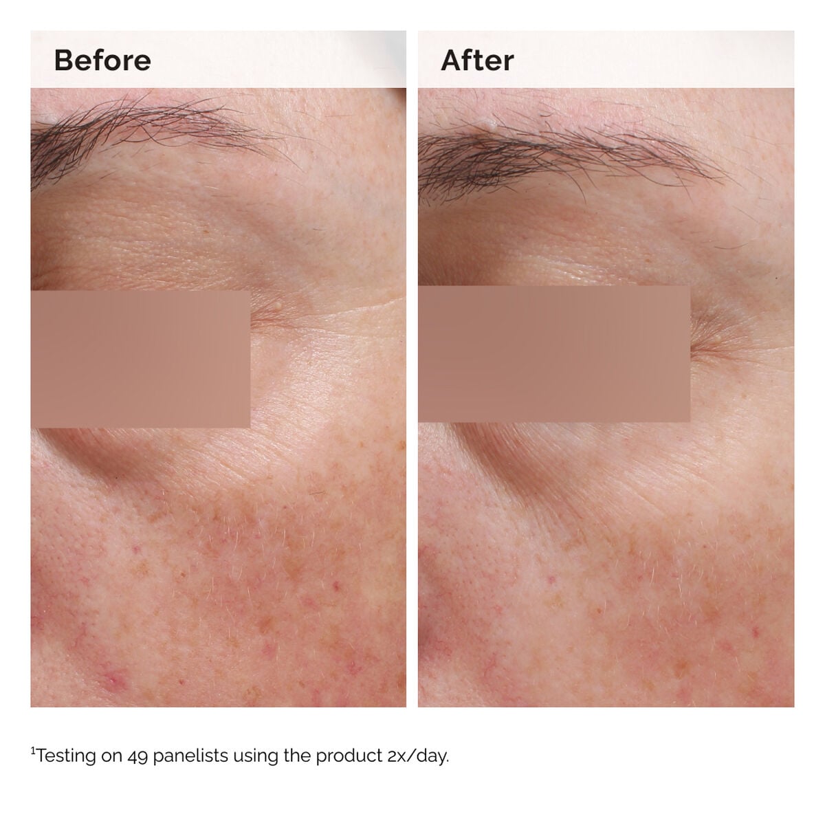 niacinamide-5-face-and-body-emulsion-c0 2024-08-23-ORD-Nia-5pct-Face-Body-B-A-Elasticity-Global-02-1x1.jpg