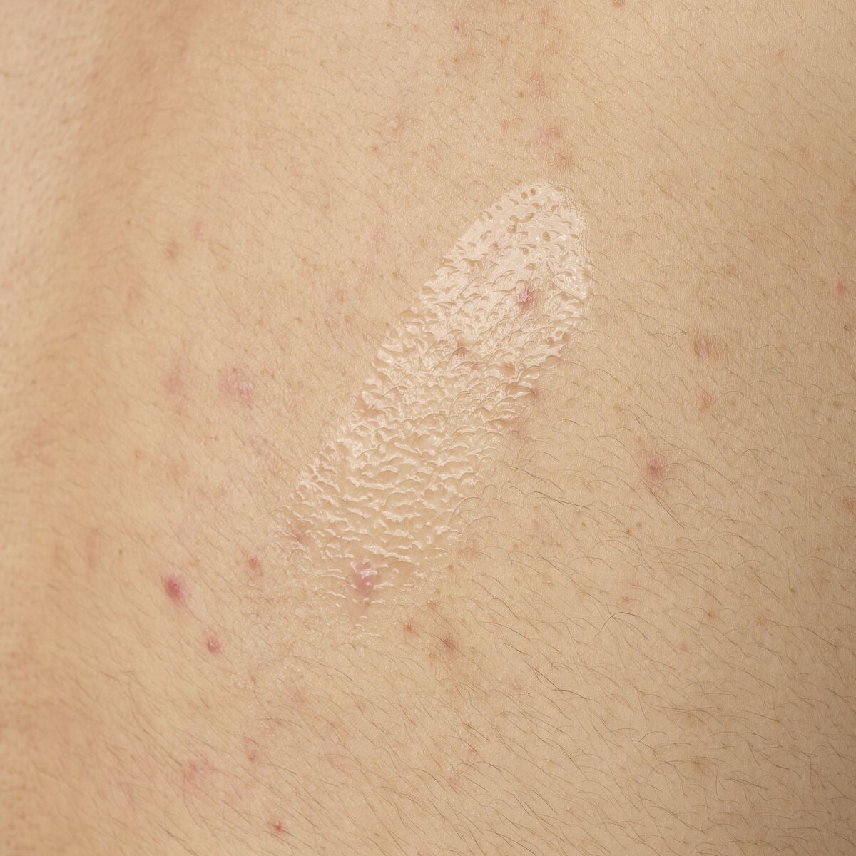 salicylic-acid-0-5-body-serum-k5 ORD-salicylic-acid-05-body-240ml-application.jpg