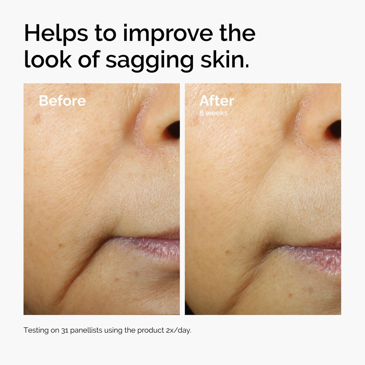 caffeine-3-escin-1-face-serum-l0 ord-caffeine-3pct-escin-1pct-face-serum-before-after-sagging.jpg