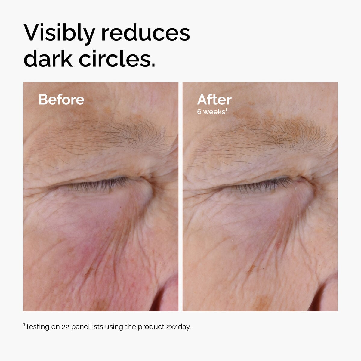 caffeine-solution-5-egcg-eye-serum-x3 ord-caffeine-solution-egcg-dark-circles-before-after.jpg