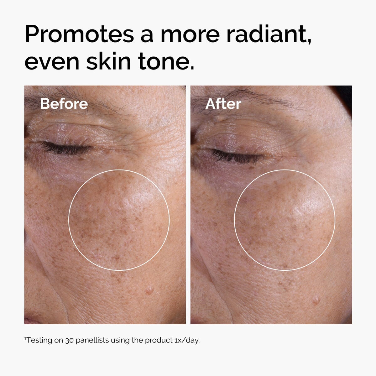 glycolic-acid-7-exfoliating-toner-e5 ord-glycolic-before-after-radiance.jpg