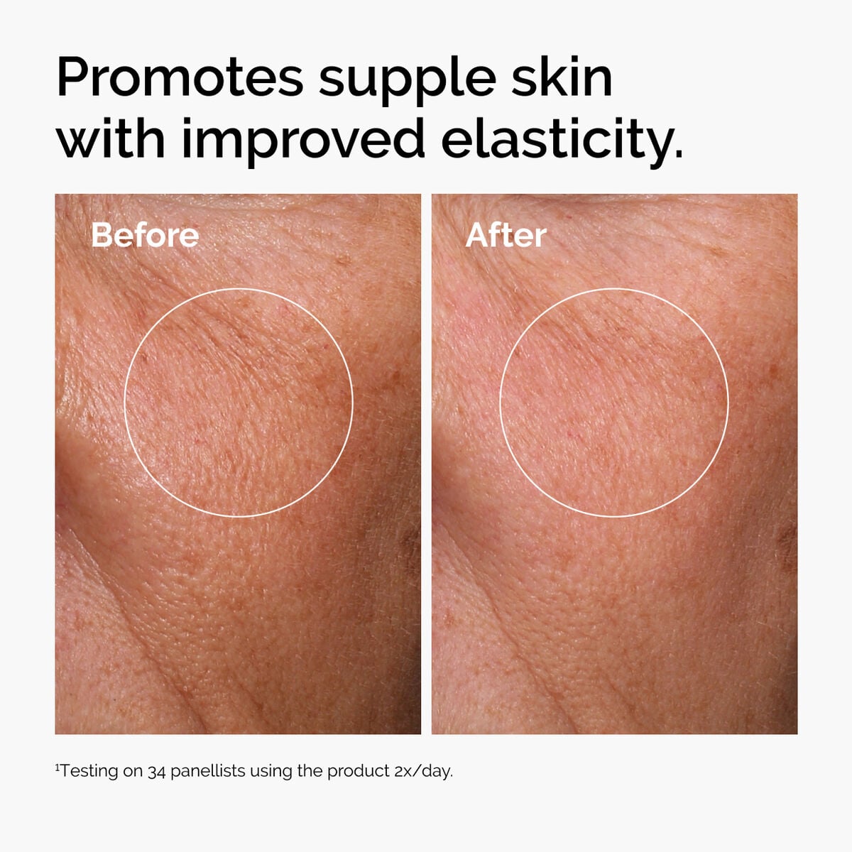 hyaluronic-acid-2-b5-with-ceramides-h5 ord-hyaluronic-acid-2pct-b5-hydrating-serum-before-after-elasticity.jpg