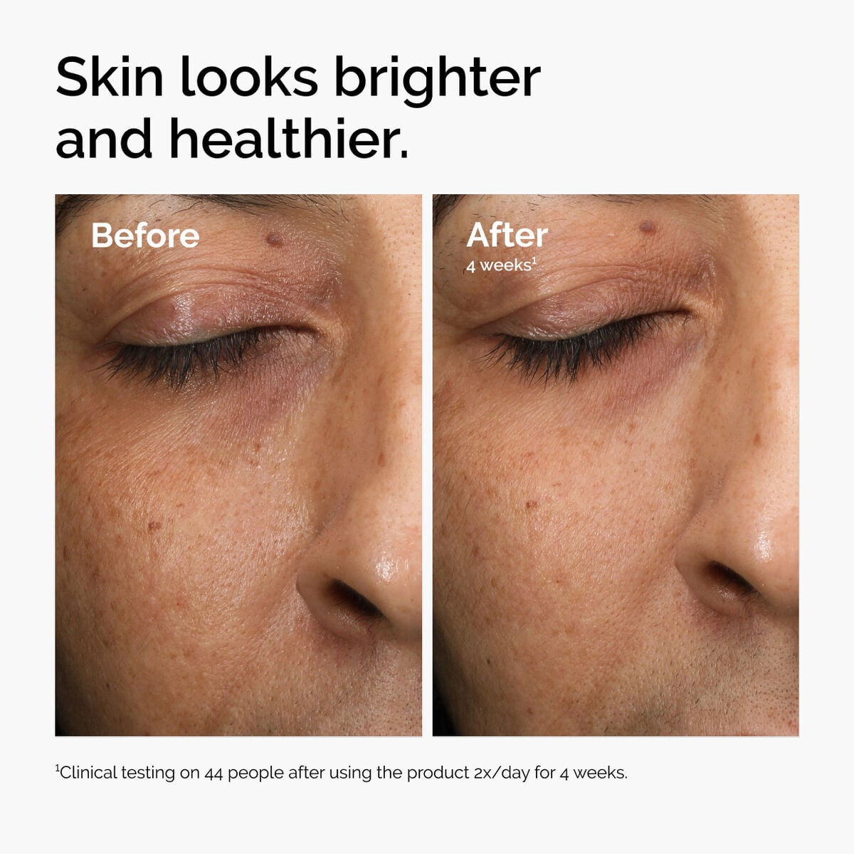 multi-antioxidant-radiance-serum-c2 ord-mars-before-after-healthy.jpg