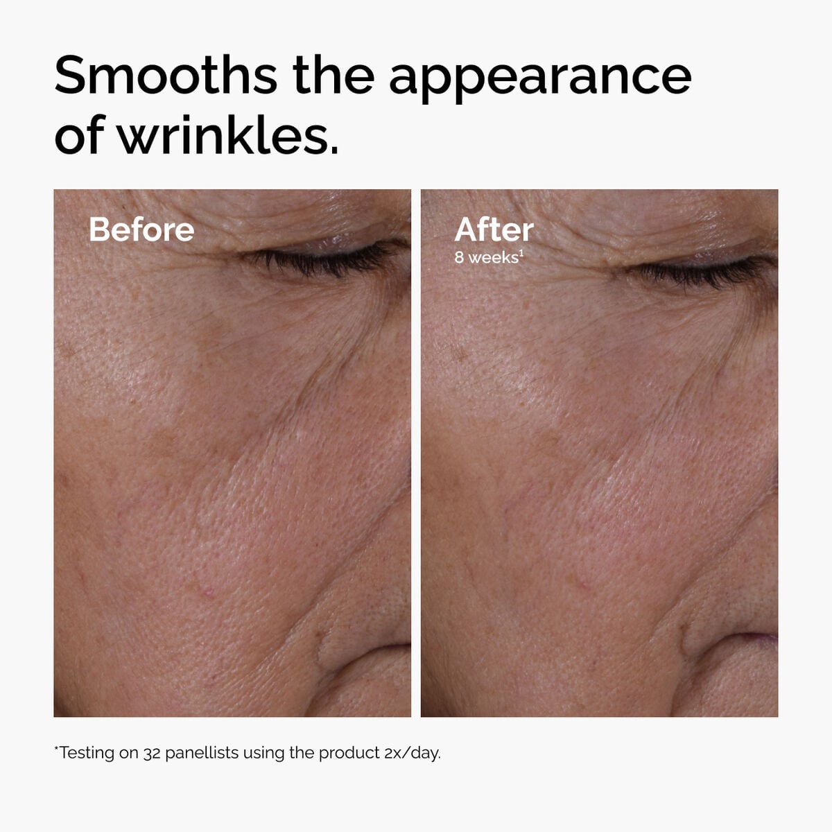 multi-peptide-ha-serum-d1 ord-multi-peptide-ha-serum-wrinkles-before-after.jpg