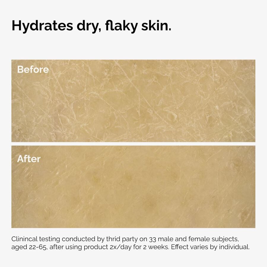 the-body-care-collection-f7 ord-natural-moisturizing-factors-inulin-body-before-after-graphic-02.jpg