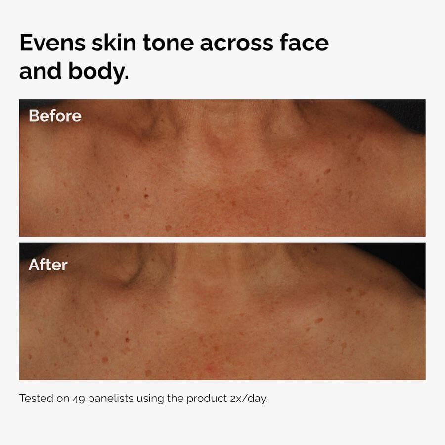 the-body-care-collection-f7 ord-niacinamide-face-body-serum-before-after-even-tone-graphic.jpg