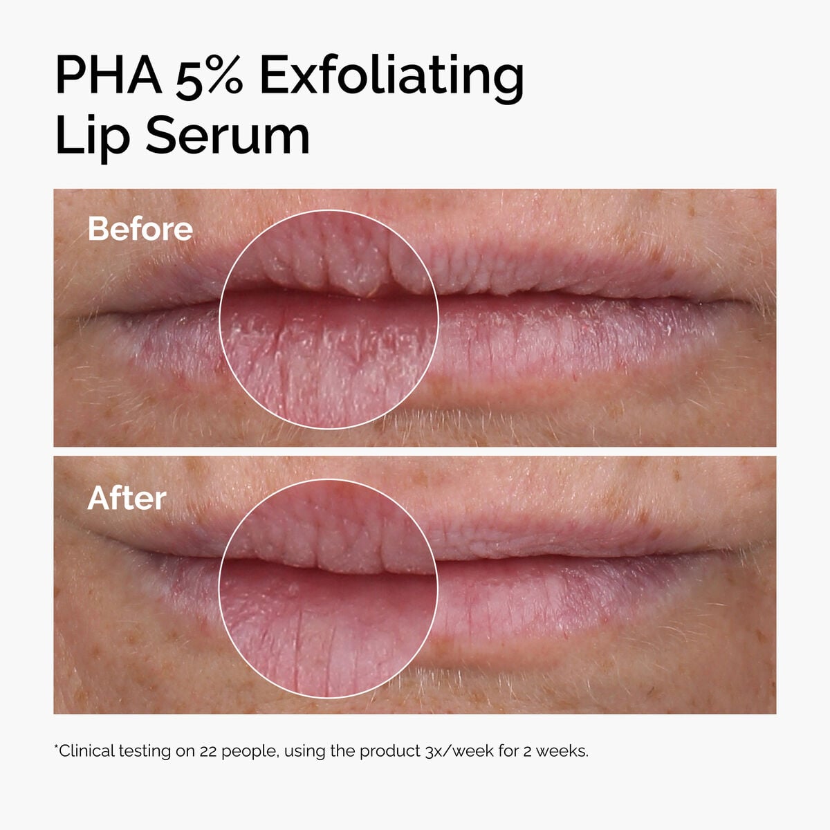 pha-5-exfoliating-lip-serum-p8 ord-pha-5pct-lip-exfoliating-serum-before-after.jpg