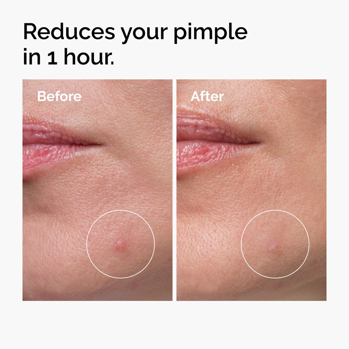 sulfur-10-powder-to-cream-concentrate-p9 ord-sulfur-10pct-powder-to-cream-concentrate-before-after-NA.jpg